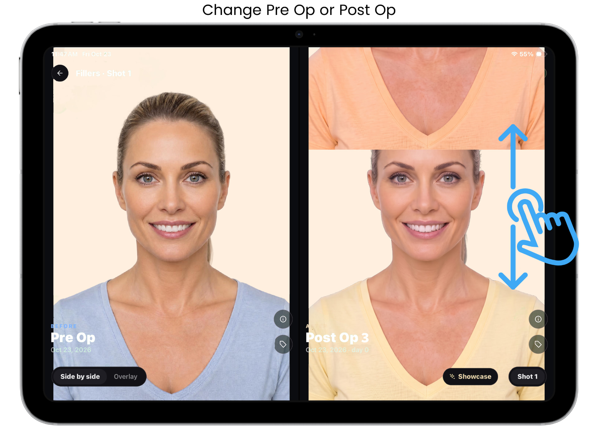 ALIGN before and after capture screen, example 8 of 9