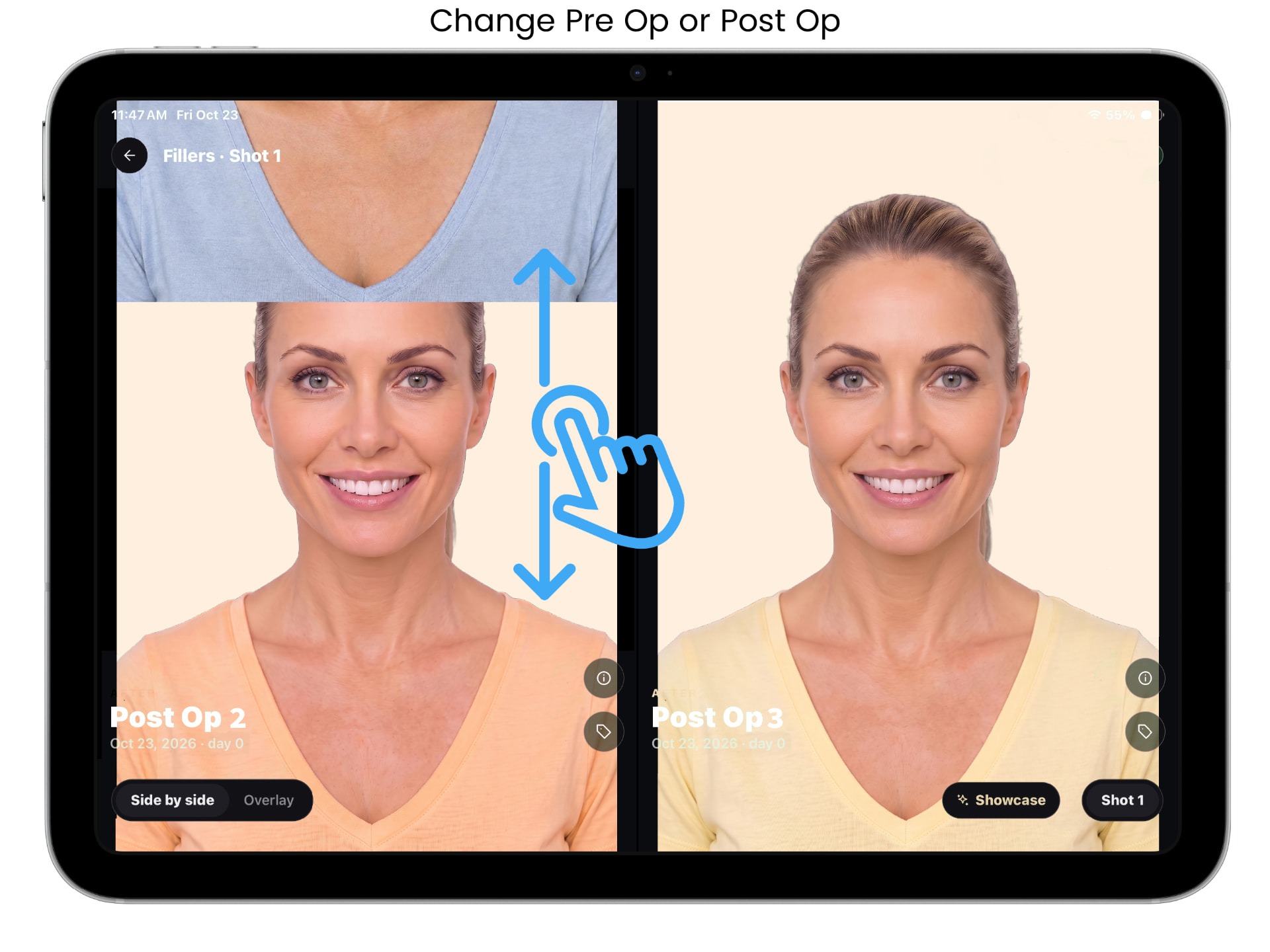 ALIGN before and after capture screen, example 9 of 9