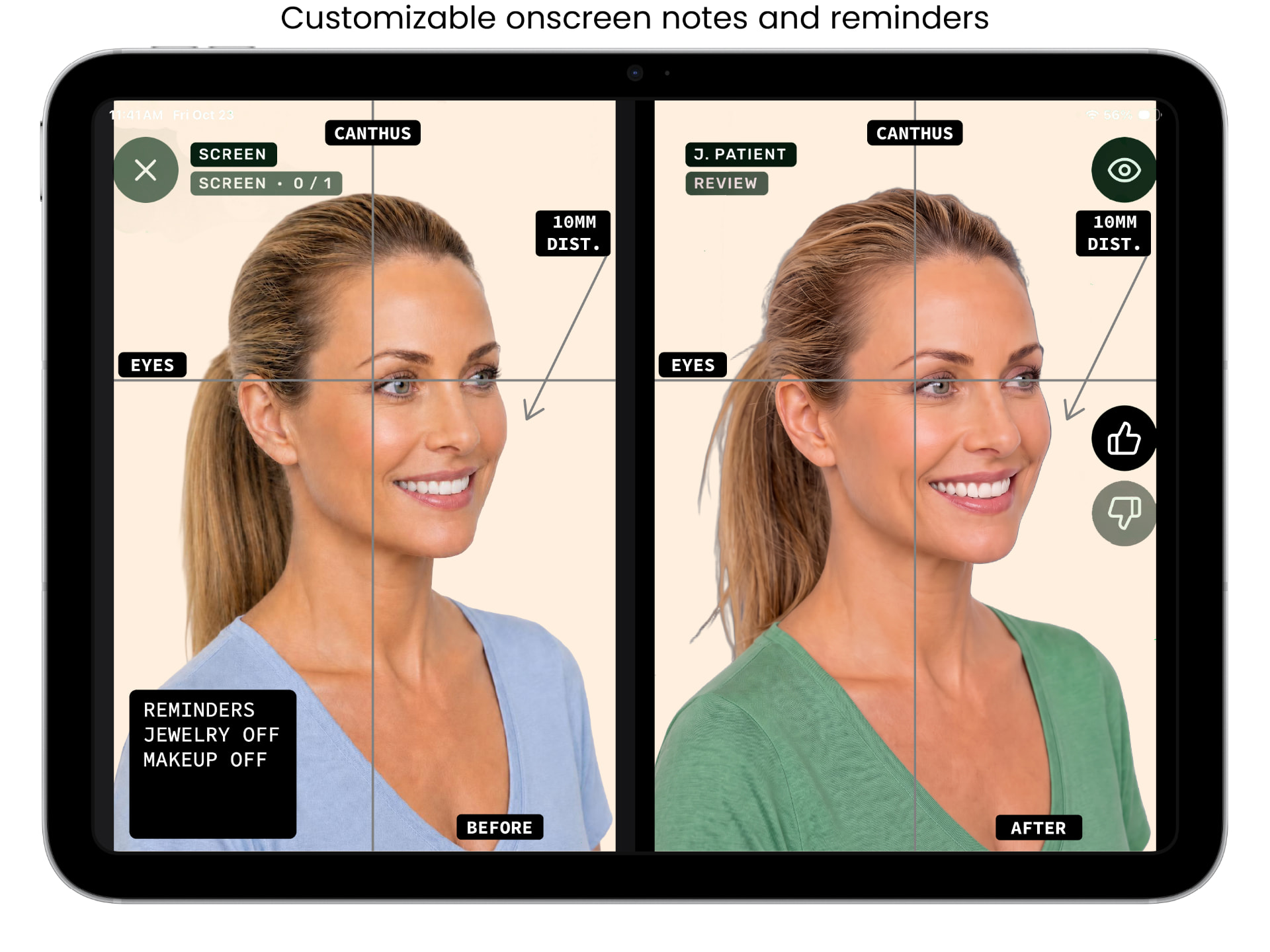 ALIGN before and after capture screen, example 2 of 9