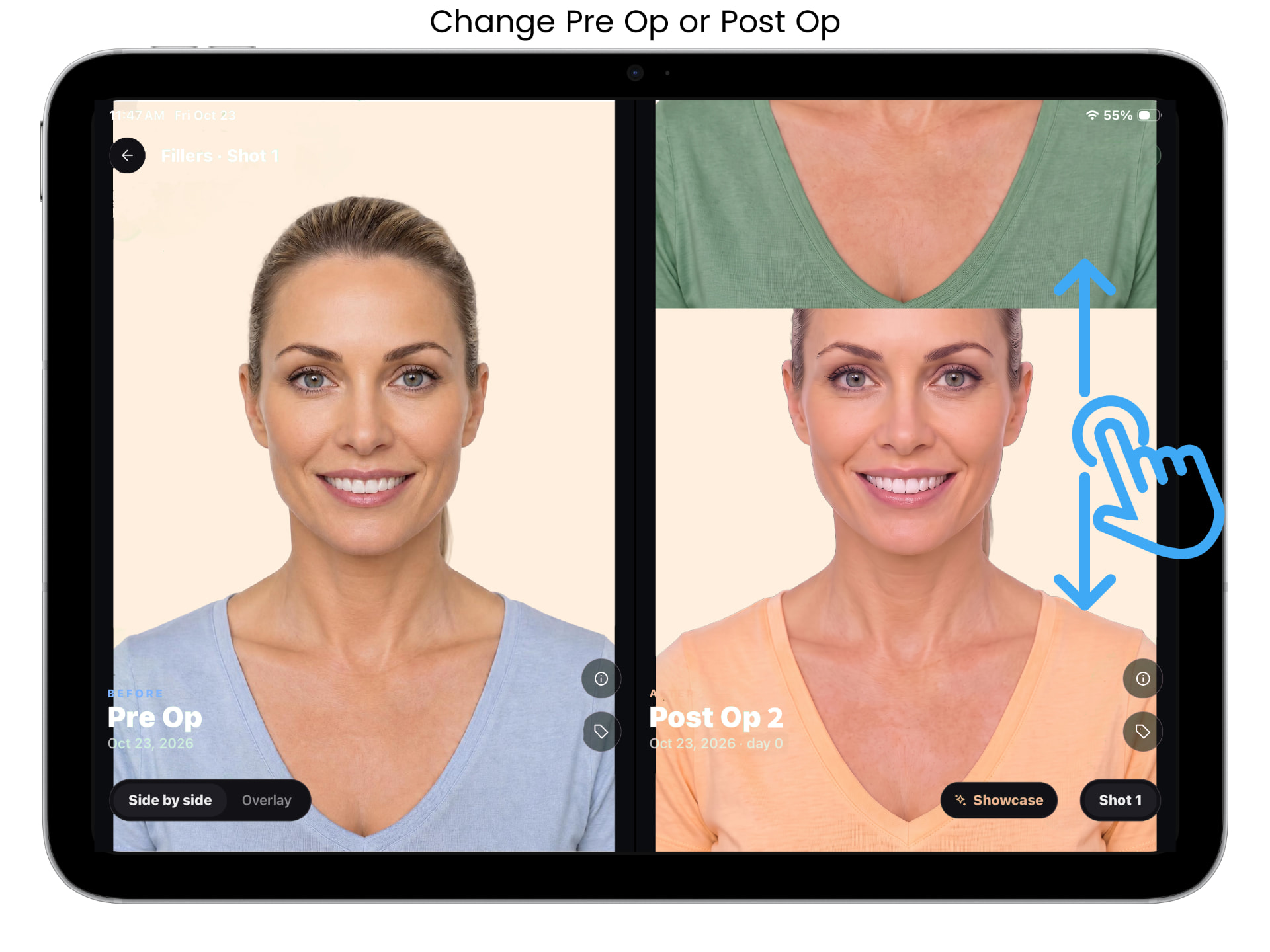 ALIGN before and after capture screen, example 7 of 9